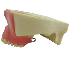 4402G-01 - MAXILLA WITH ALL TEETH AND GUM + 3RD MOLAR ENCLOSED