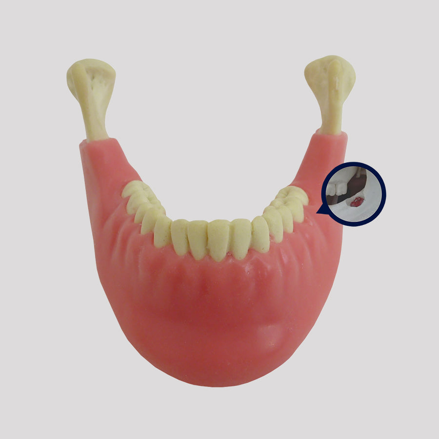 4402G-02 - MANDIBLE WITH ALL TEETH AND GUM + 3RD MOLAR