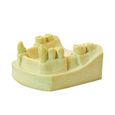 4701 – MANDIBLE WITH MISSING TEETH - SET 1