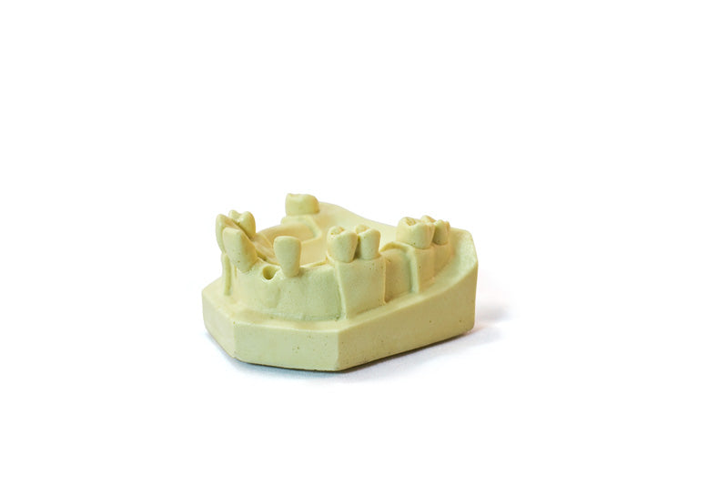 4802 – MAXILLA WITH MISSING TEETH - SET 2