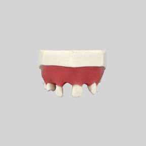 4802G - MAXILLA WITH MISSING TEETH  AND GUM - SET 2