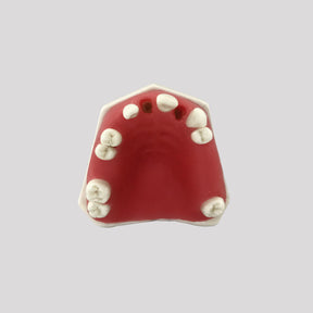 4802G - MAXILLA WITH MISSING TEETH  AND GUM - SET 2