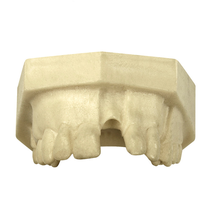 4803 – MAXILLA WITH MISSING TEETH - SET 3