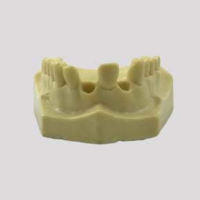 12308 - RADIOPAQUE MAXILLA WITH PARTIAL ABSENCE