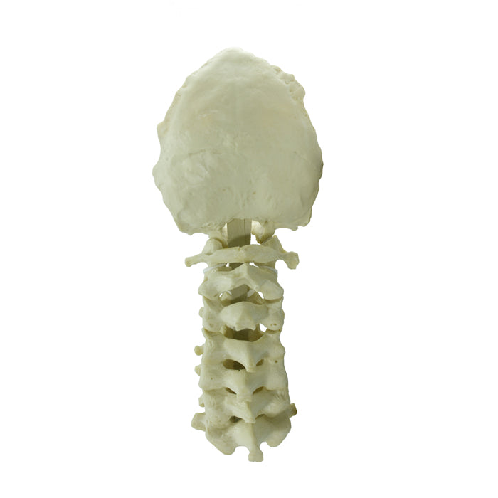 12463 - CERVICAL SPINE WITH OCCIPITAL