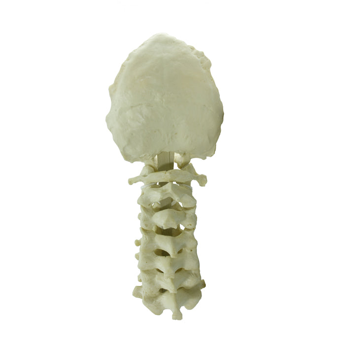 5002 - CERVICAL SPINE WITH OCCIPITAL