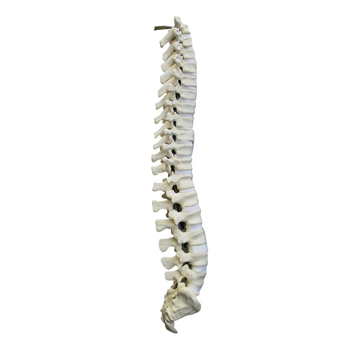 5003 - THORACIC LUMBAR SPINE WITH SACRUM