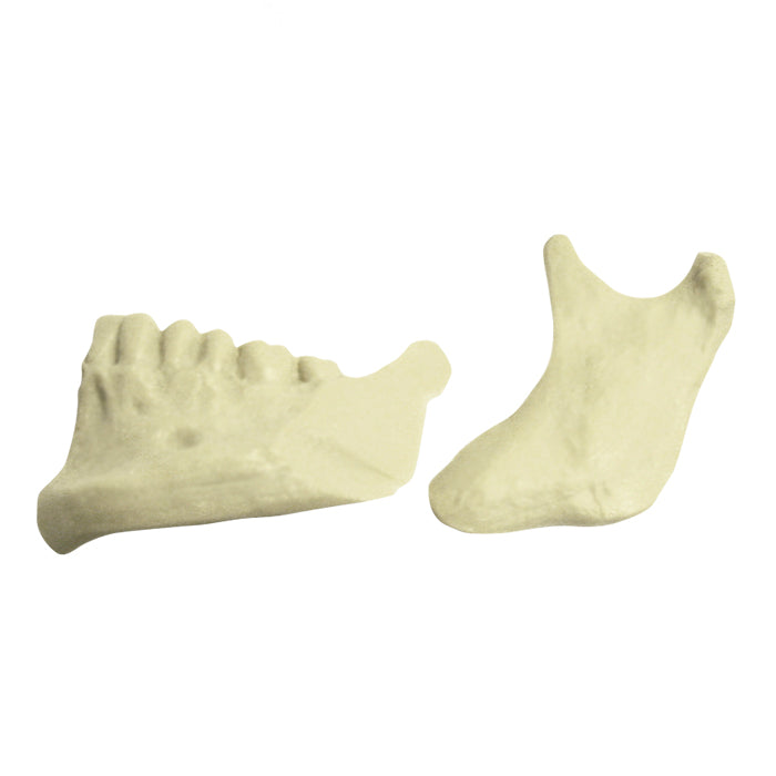 4029 - HALF MANDIBLE WITH SAGITAL OSTEOTOMY (LEFT SIDE)