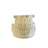 4034 - ORTHODONTIC MODEL WITH EXPOSED BONE