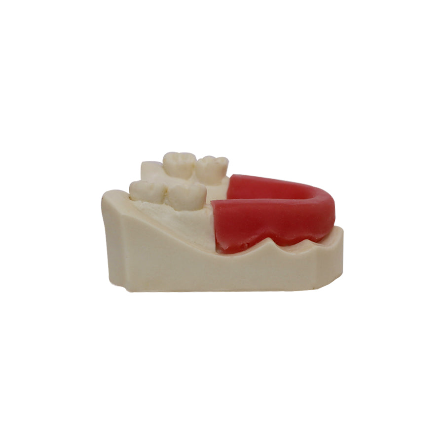 4200 - BASIC MODEL WITH SOME TEETH AND PARTIAL GUM