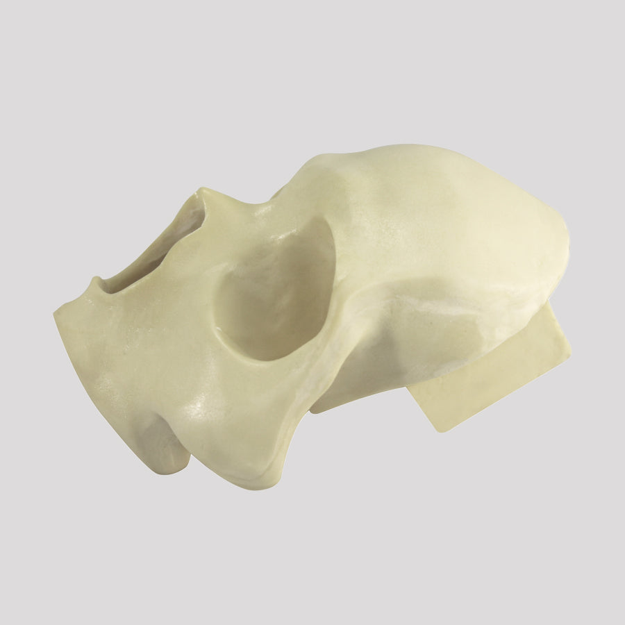 12258 - FRONTAL SKULL All-on-4® STANDARD RADIOPAQUE