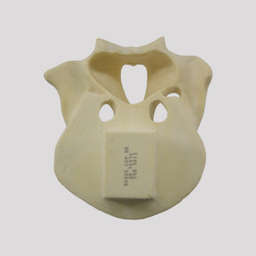 12259 - FRONTAL SKULL All-on-4® RADIOPAQUE HYBRID