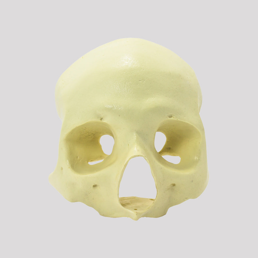 12260 - FRONTAL SKULL All-on-4® RADIOPAQUE ZIGOMATIC