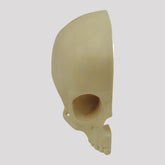 12263 - RIGHT RADIOPAQUE LONGITUDINAL CHILD SKULL