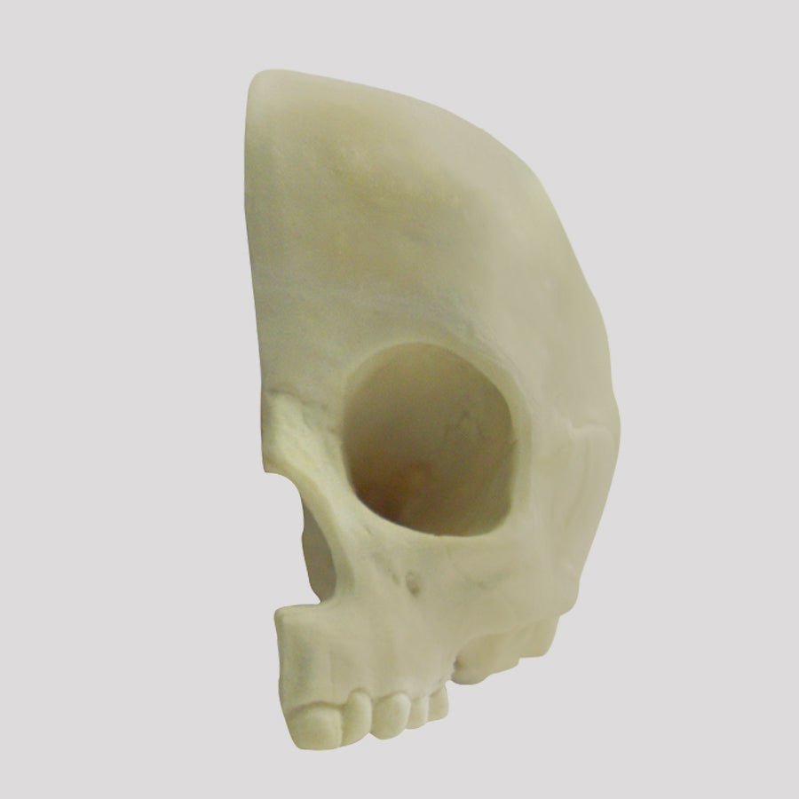 12264 - LEFT LONGITUDINAL CHILD RADIOPAQUE SKULL