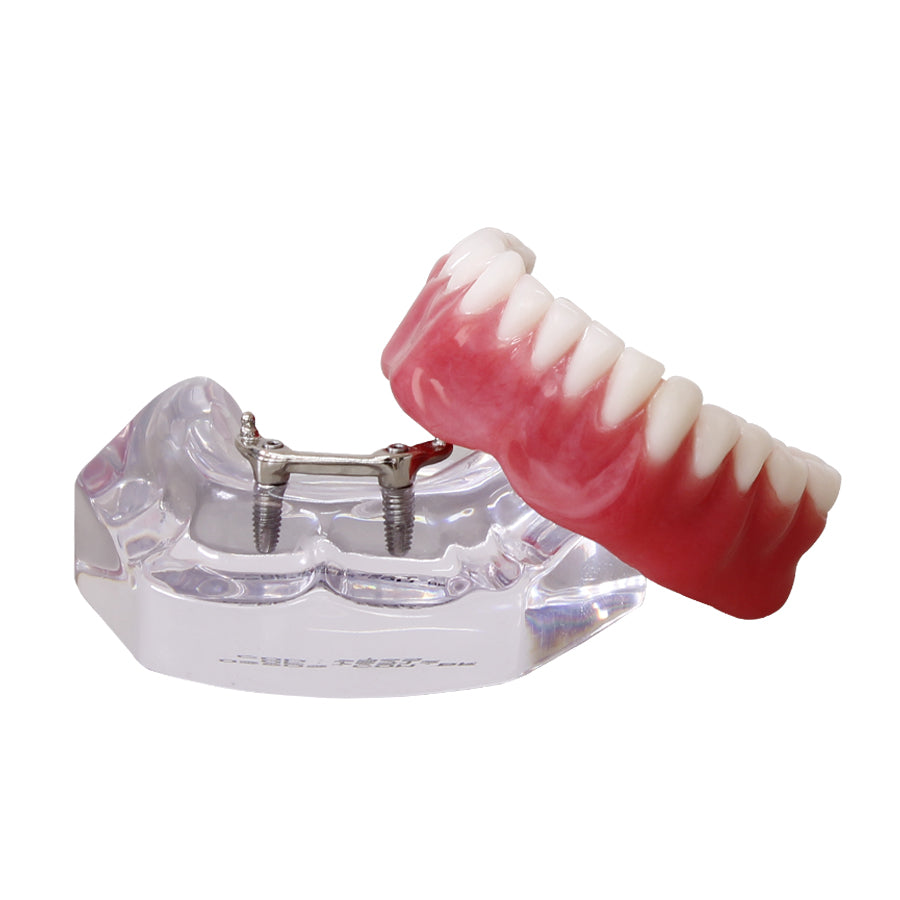 9565 – ACRYLIC MANDIBLE WITH CLIP BAR AND O'RINGS + PROSTHESIS