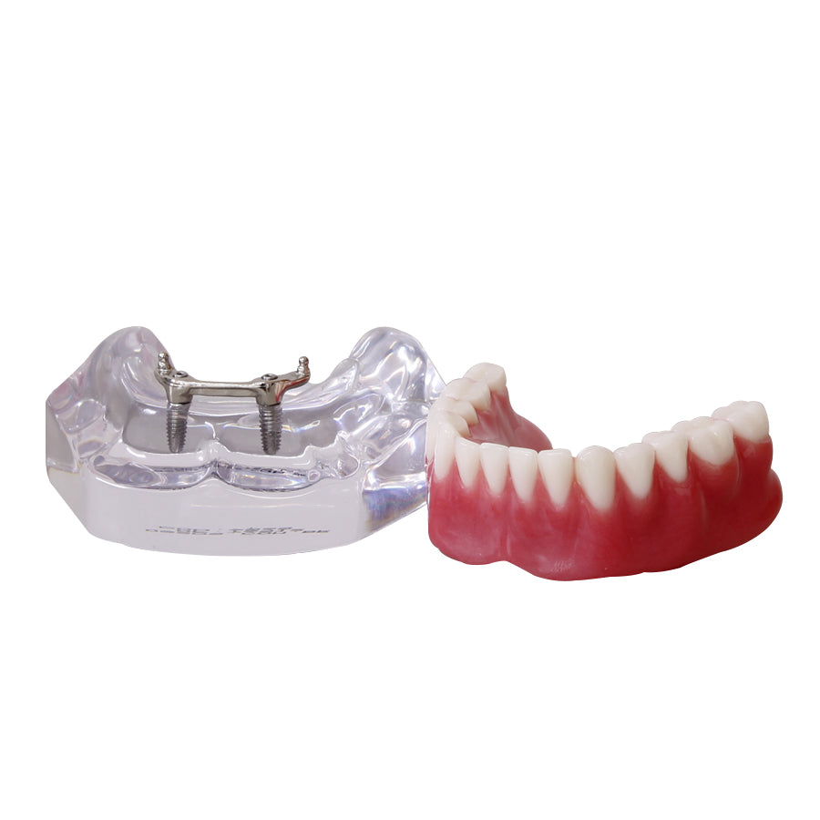 9565 – ACRYLIC MANDIBLE WITH CLIP BAR AND O'RINGS + PROSTHESIS