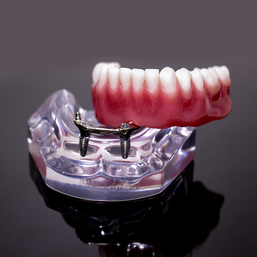 9565 – ACRYLIC MANDIBLE WITH CLIP BAR AND O'RINGS + PROSTHESIS