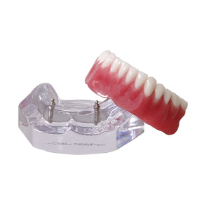 9566 – ACRYLIC MANDIBLE WITH 2 O'RINGS AND PROSTHESIS