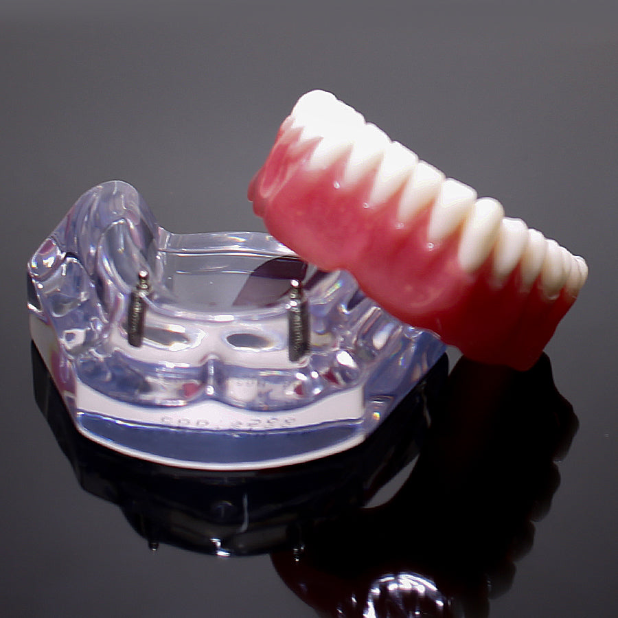 9566 – ACRYLIC MANDIBLE WITH 2 O'RINGS AND PROSTHESIS