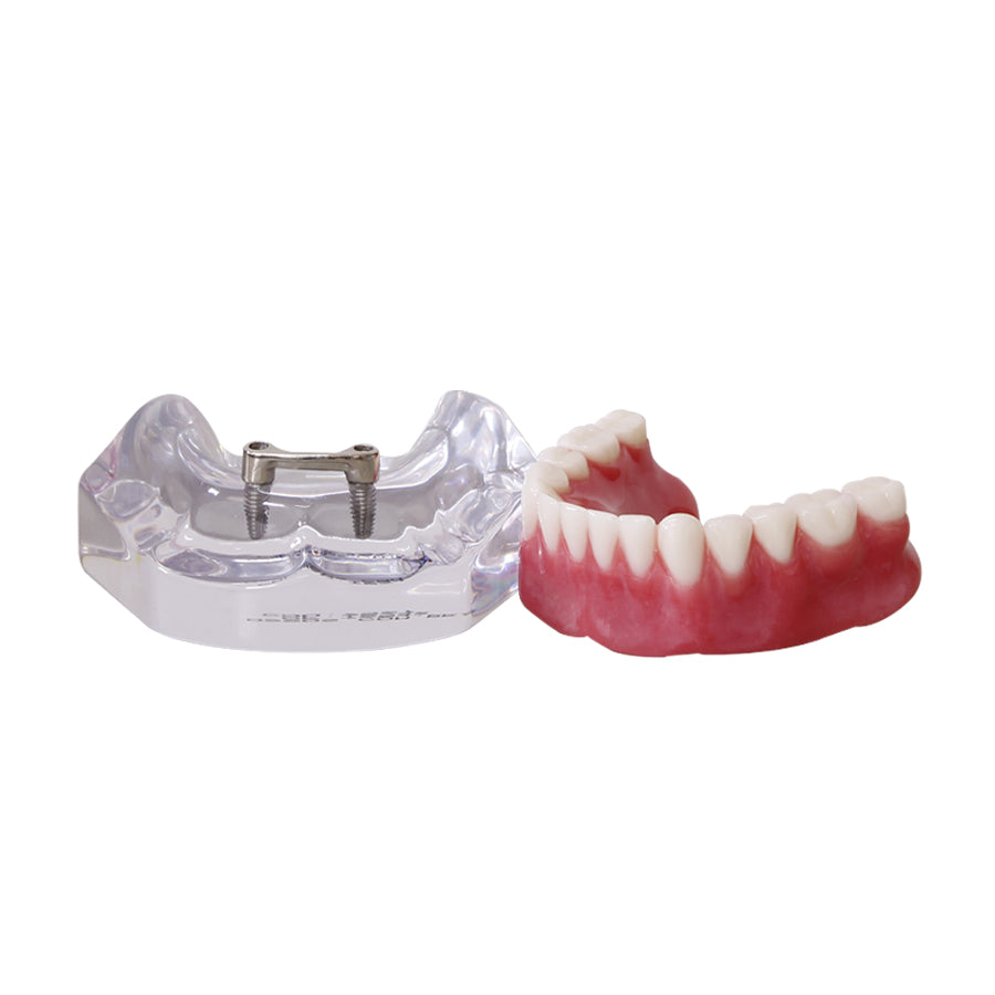 9567 – ACRYLIC MANDIBLE WITH CLIP BAR AND PROSTHESIS