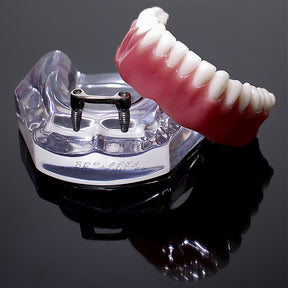 9567 – ACRYLIC MANDIBLE WITH CLIP BAR AND PROSTHESIS