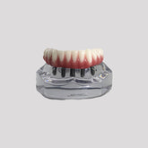 9569 - ACRYLIC MANDIBLE WITH PROTOCOL AND 5 IMPLANTS