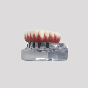 9569 - ACRYLIC MANDIBLE WITH PROTOCOL AND 5 IMPLANTS