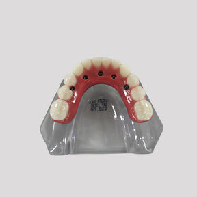 9569 - ACRYLIC MANDIBLE WITH PROTOCOL AND 5 IMPLANTS