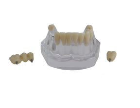 9570 – ACRYLIC MANDIBLE WITH TEETH AND 3 IMPLANTS