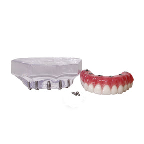 9571 – ACRYLIC MAXILLA WITH 6 IMPLANTS AND PROTOCOL