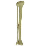 9700 - LEFT TIBIA WITH MIDSHAFT FRACTURE