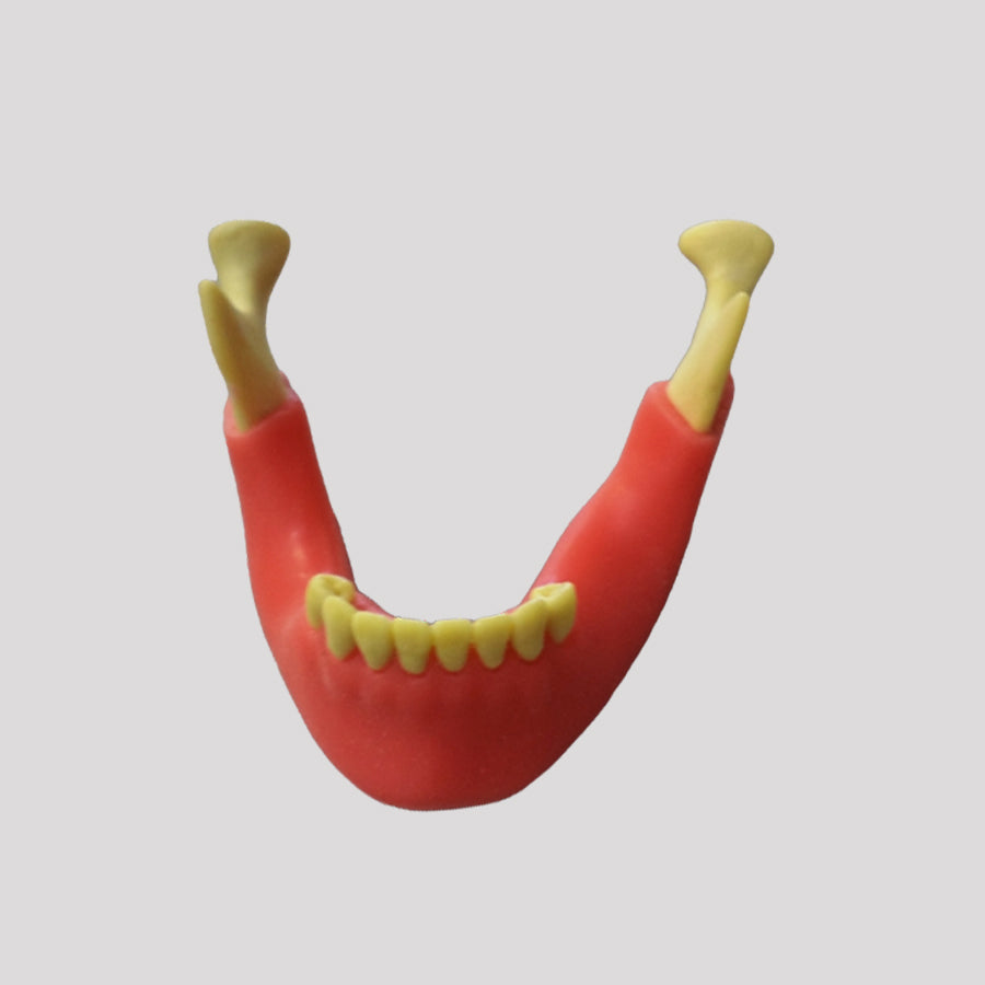 9971 IGT - RGT JAW WITH GINGIVA