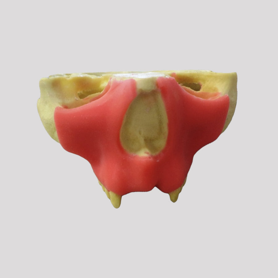 9971 SGT - MAXILLA WITH GUMS AND ABSENCE OF TEETH 12/11 / 21 AND 22