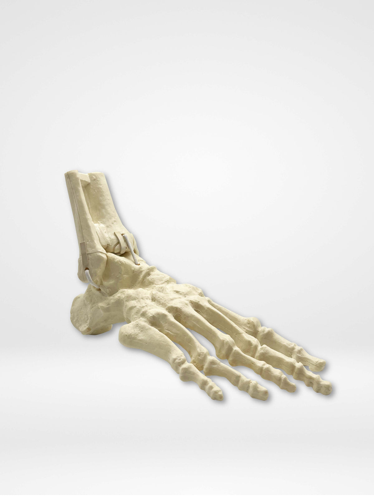 9699 - RIGHT ANKLE - FRACTURE 1