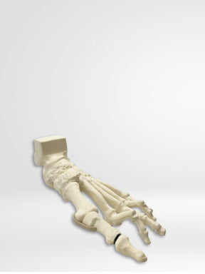 13635 - Rotation Lapidus and MIS Bunion trainer with Deformity