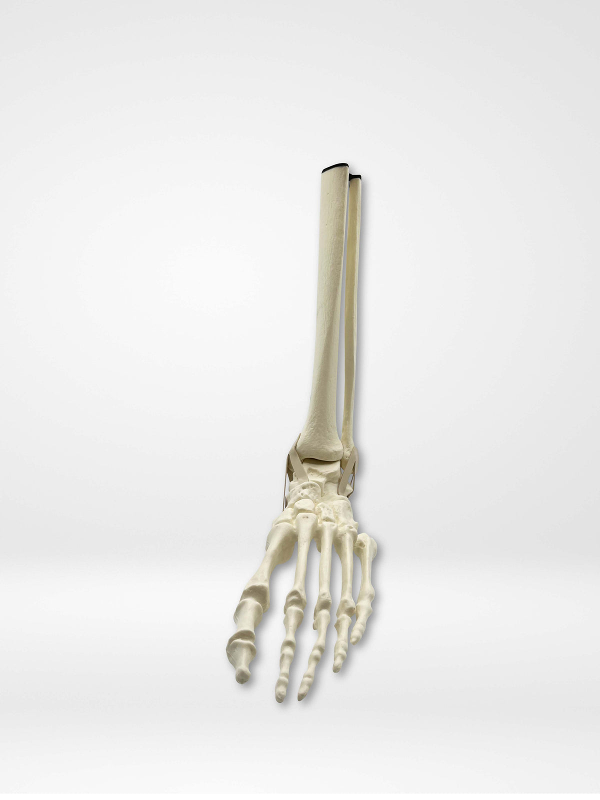 13656 - Left Articulated Ankle with Mid Shaft Tibia and Fibula