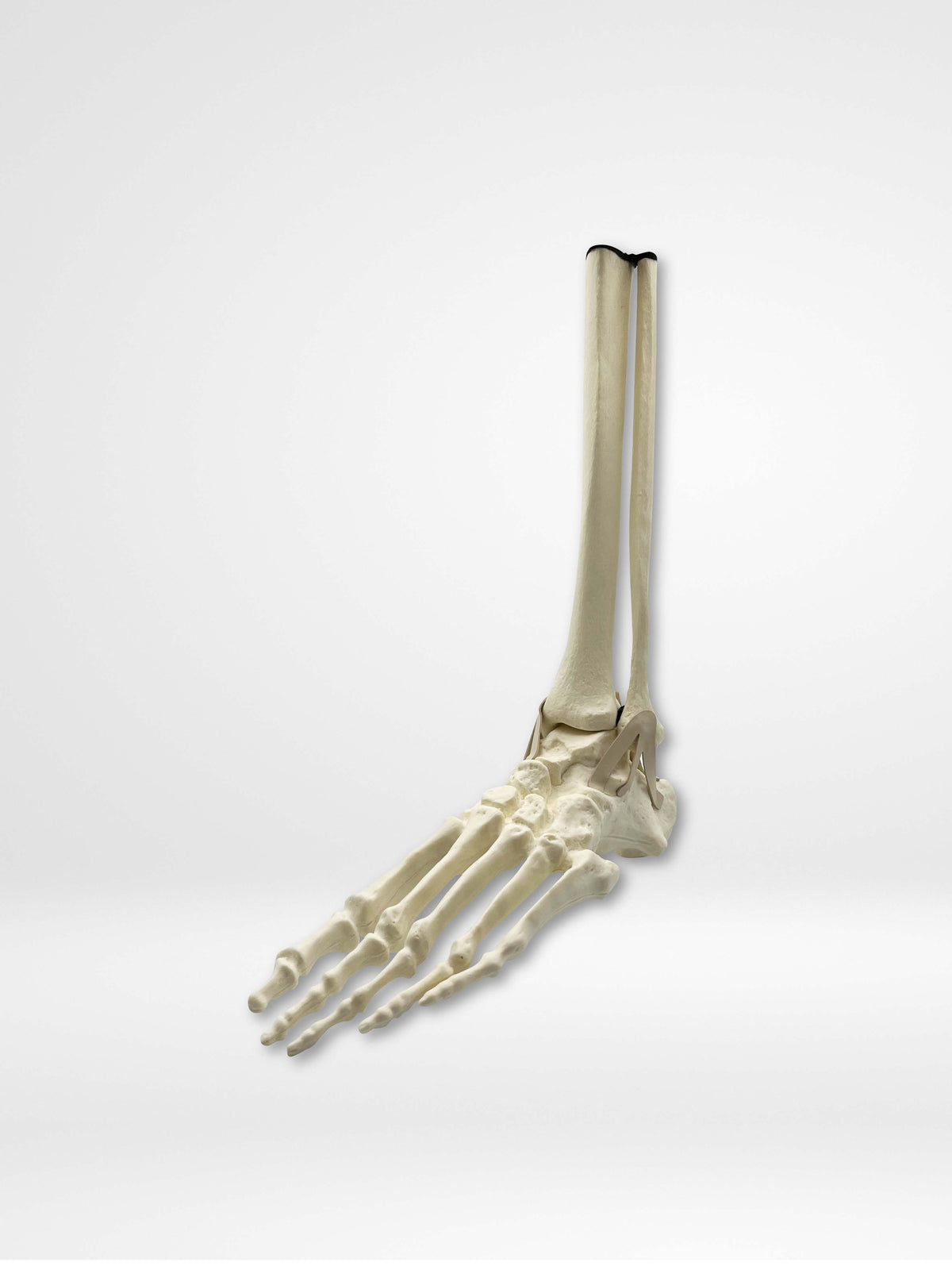 13656 - Left Articulated Ankle with Mid Shaft Tibia and Fibula