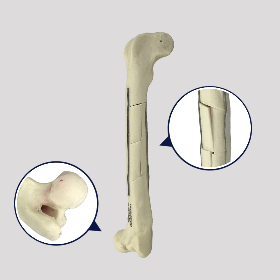 AV200ESPF3 - RIGHT FEMUR CANINE WITH MED. CANAL, CANC. MATERIAL AND COMMINUTED FX