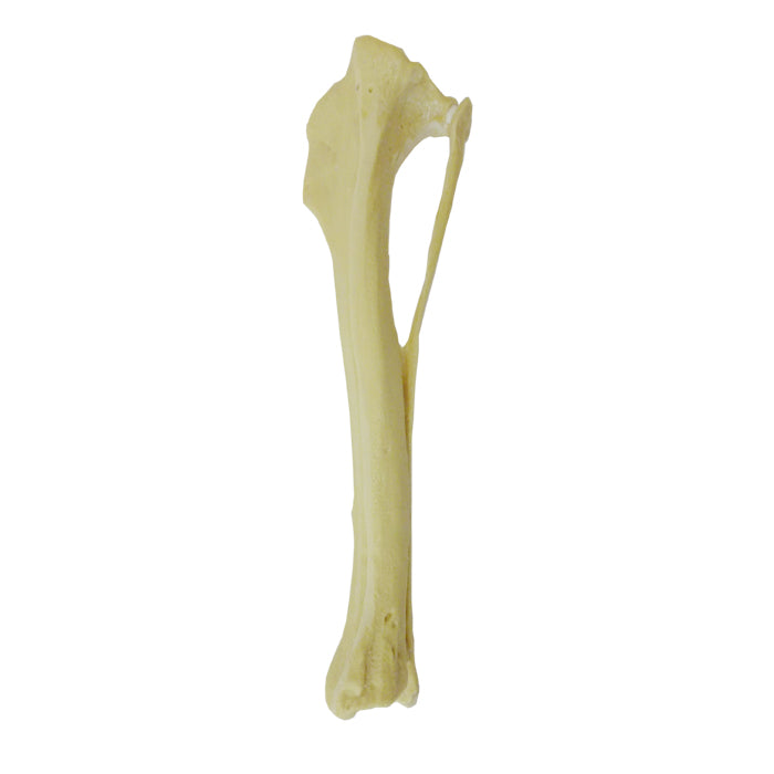 12693 - RIGHT CANINE TIBIA WITH FIBULA, MED. CANAL, CANC. MATERIAL AND PROXIMAL VALGUS DEFORMITY