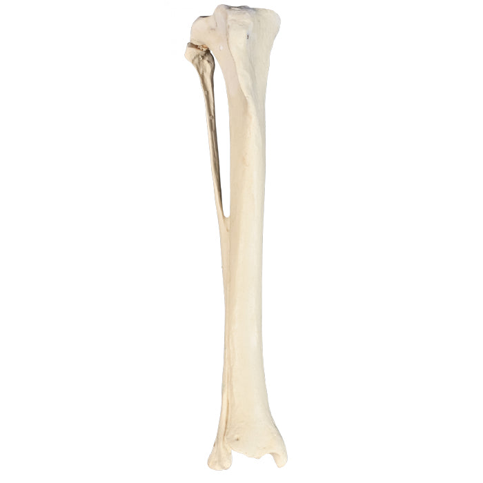 AV210ESP - RIGHT TIBIA CANINE WITH FIBULA, MED. CANAL AND CANC. MATERIAL