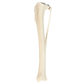AV210ESP - RIGHT TIBIA CANINE WITH FIBULA, MED. CANAL AND CANC. MATERIAL