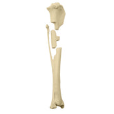 12726 - RIGHT CANINE TIBIA WITH MED. CANAL, CANC. MATERIAL AND DOUBLE MEDIAL FX