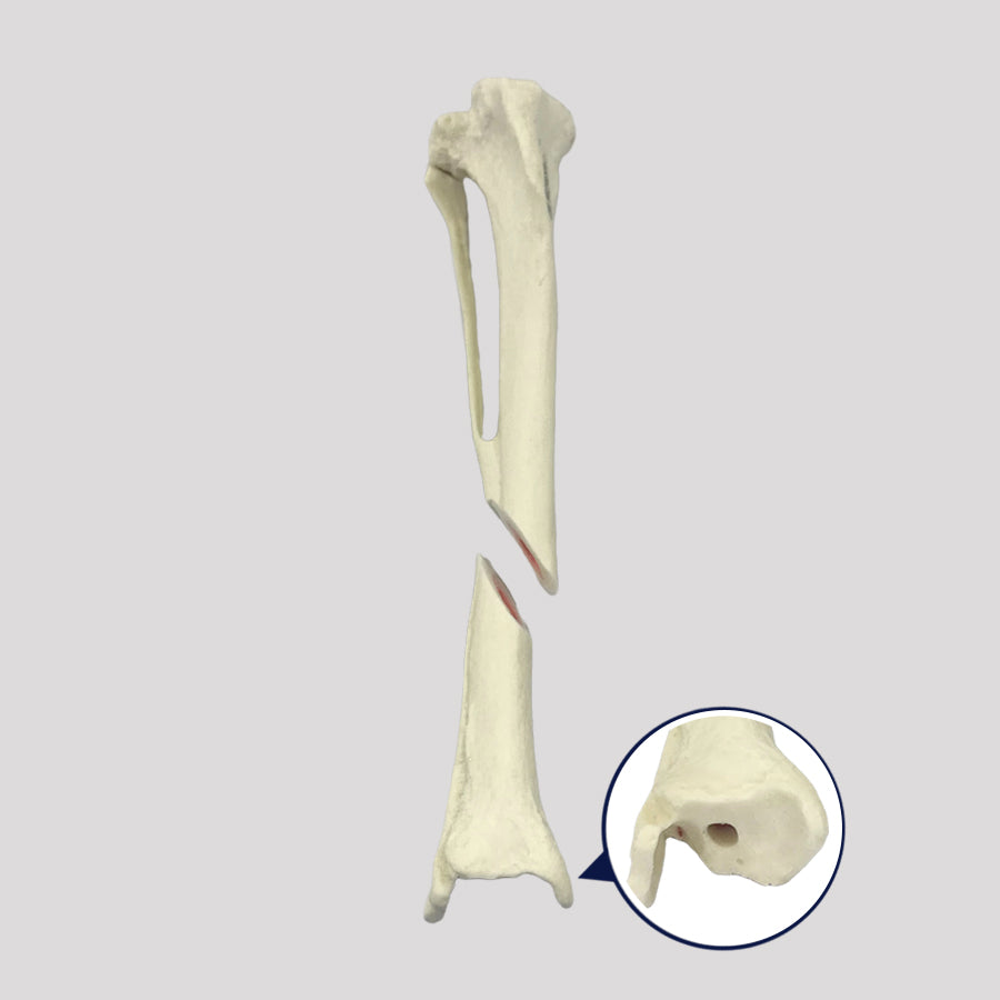 12723 - RIGHT CANINE TIBIA WITH MED. CANAL, CANC. MATERIAL AND DISTAL FX