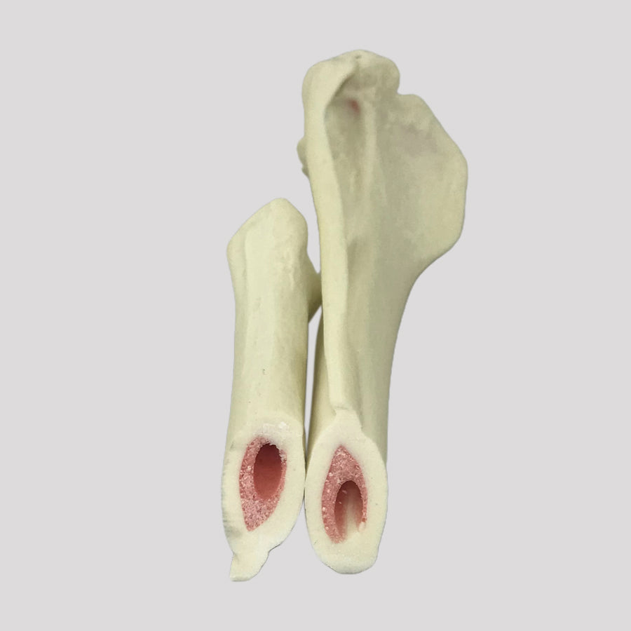 12723 - RIGHT CANINE TIBIA WITH MED. CANAL, CANC. MATERIAL AND DISTAL FX