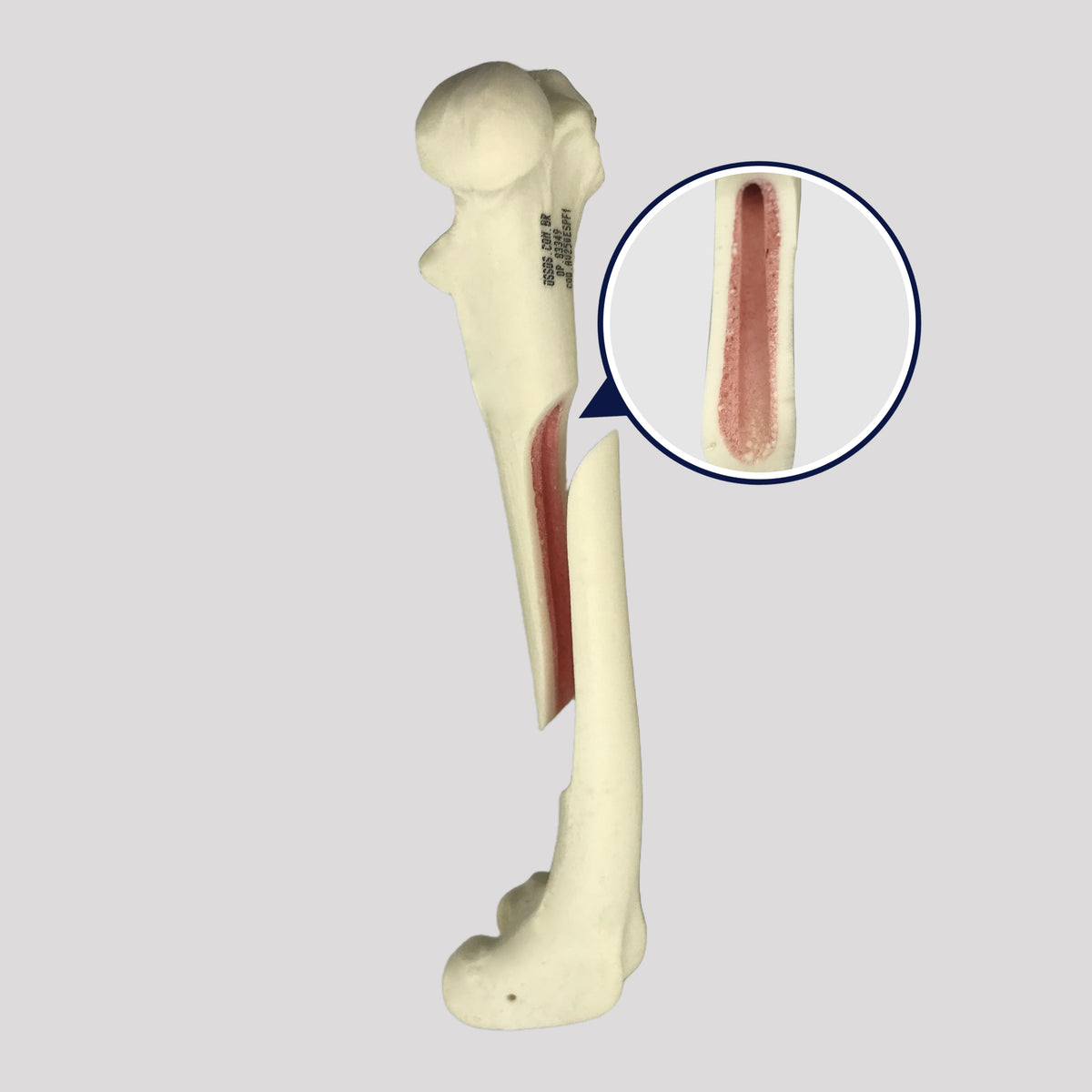 AV250ESPF1 - LEFT FEMUR CANINE WITH MED. CANAL, CANC. MATERIAL AND MEDIAL FX (OBLIQUE)