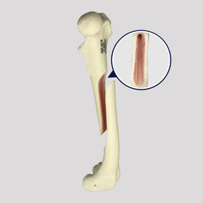 AV250ESPF1 - LEFT FEMUR CANINE WITH MED. CANAL, CANC. MATERIAL AND MEDIAL FX (OBLIQUE)