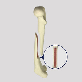 AV250ESPF1 - LEFT FEMUR CANINE WITH MED. CANAL, CANC. MATERIAL AND MEDIAL FX (OBLIQUE)