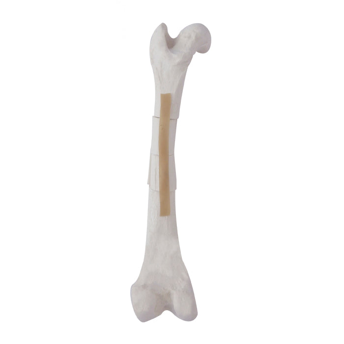 AV250ESPF3 - LEFT CANINE FEMUR WITH MED. CANAL, CANC. MATERIAL AND COMMINUTED FX