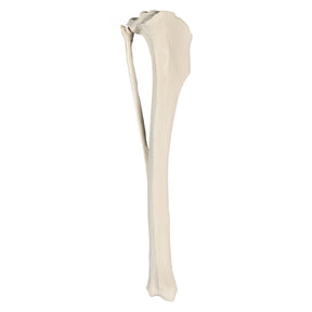 AV260ESP - LEFT CANINE TIBIA WITH FIBULA, MED. CANAL AND CANC. MATERIAL